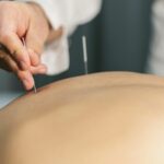 Top 3 Things People Should Know About Acupuncture