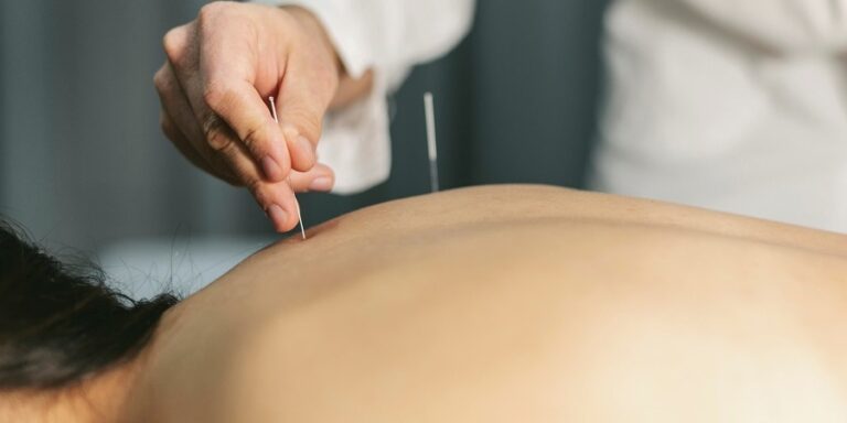 Top 3 Things People Should Know About Acupuncture