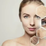 About Your Health Skin