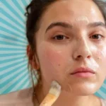 Home Treatments Acne Simple